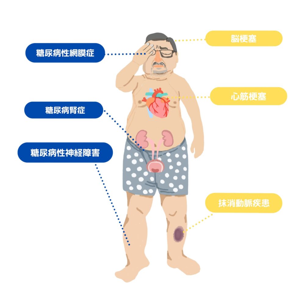 糖尿病の3大合併症