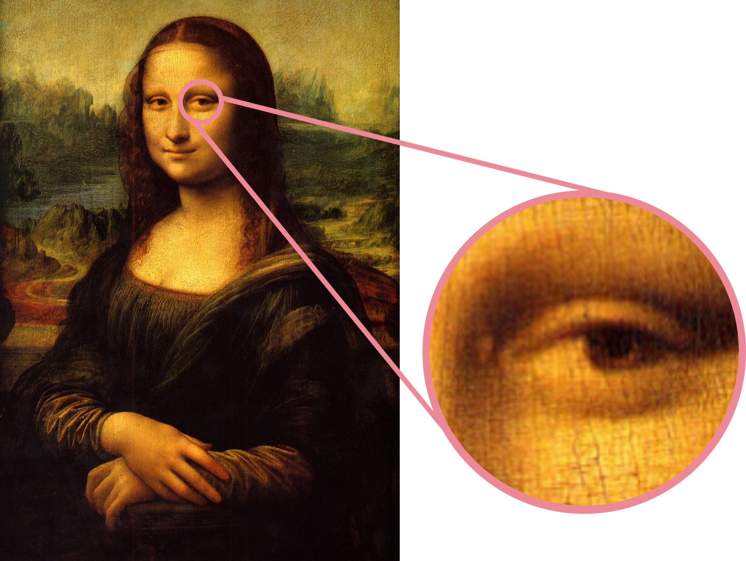 脂質異常の症状